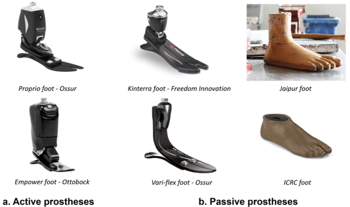 Bionic foot powered by the brain