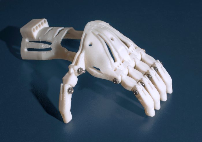 Talon hand 2 0 prosthetic hand created by father for son