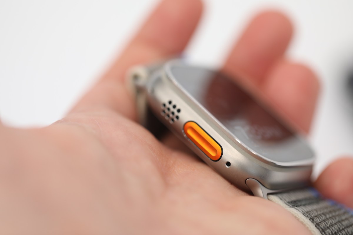 Glucose monitoring might not make it onto the iwatch