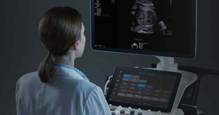 Samsung medison to aqcuire french ai ultrasound startup sonio for 92 7m