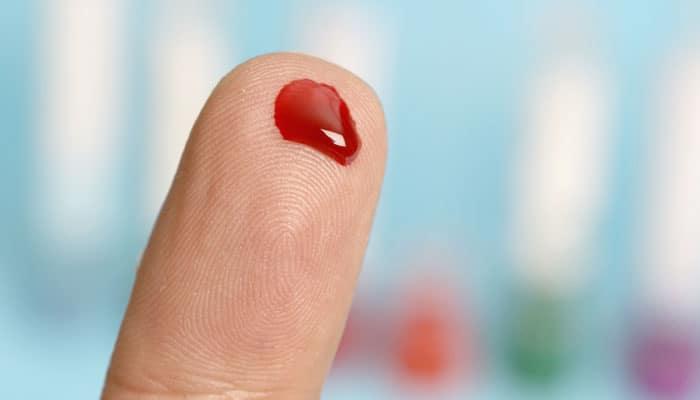 Single drop of blood enough for 30 lab tests