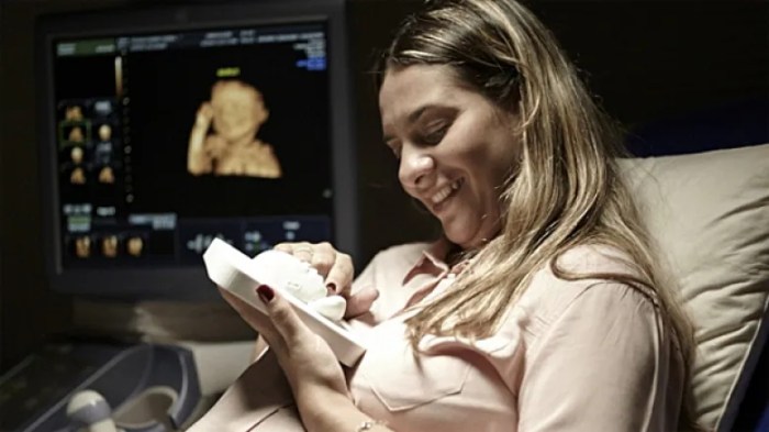 3d printing allows blind mom to see her ultrasound scan