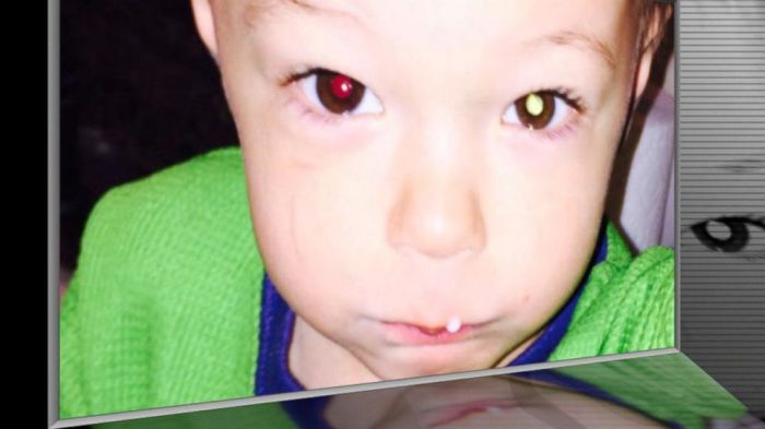 Cellphone camera reveals rare form of cancer in a 2 year old