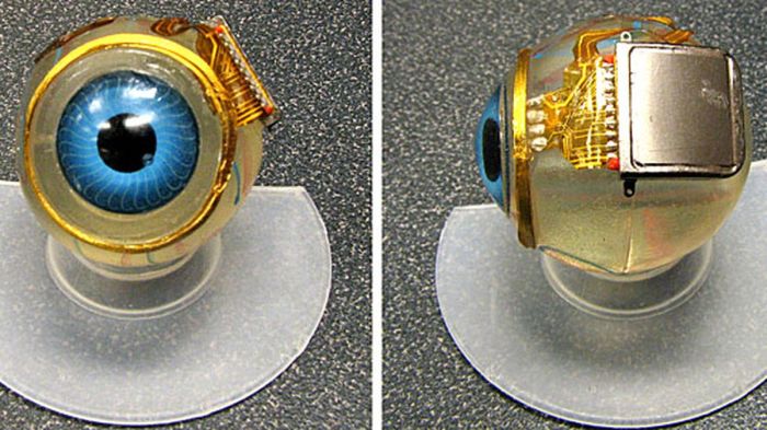 First bionic eye implanted by umhs doctors