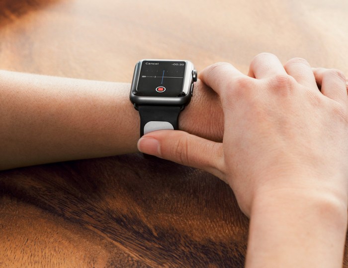 Fda clears ekg analyzer apple watch