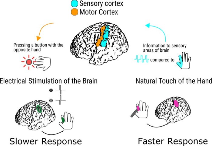 Brain electrodes less damaging placement