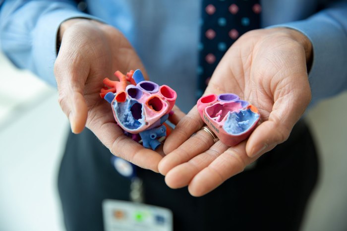 3d printer could serve up a new heart