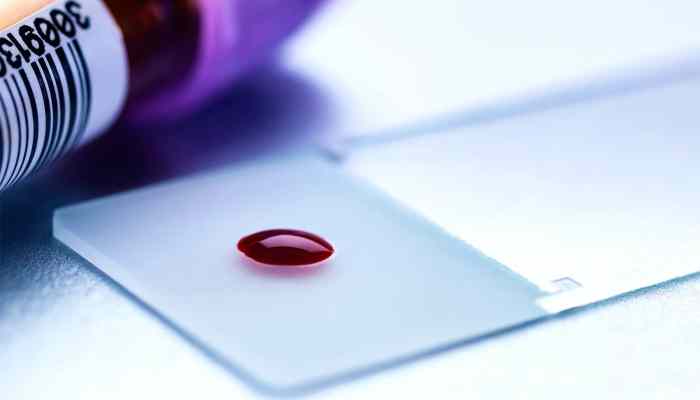 Single drop of blood enough for 30 lab tests